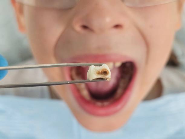 Best Emergency Treatment for Toothache in Freeport, PA